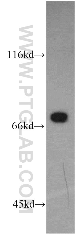 Western Blot (WB) analysis of mouse small intestine tissue using PLS1 Polyclonal antibody (55212-1-AP)