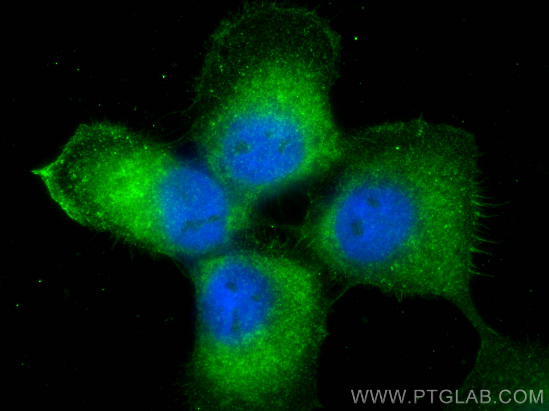 Immunofluorescence (IF) / fluorescent staining of A431 cells using PLS3 Polyclonal antibody (12917-1-AP)
