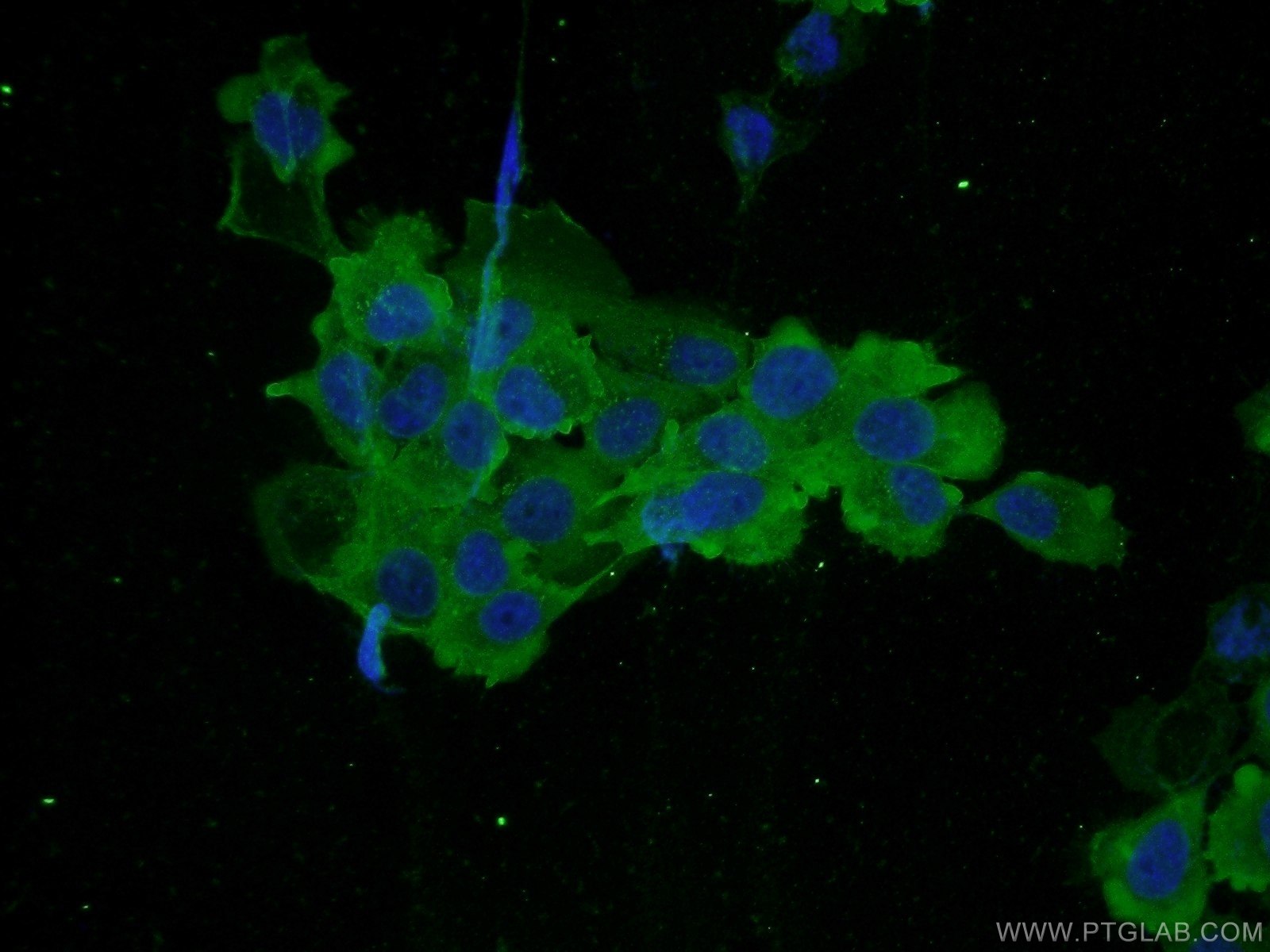 Immunofluorescence (IF) / fluorescent staining of A431 cells using PLS3 Polyclonal antibody (12917-1-AP)