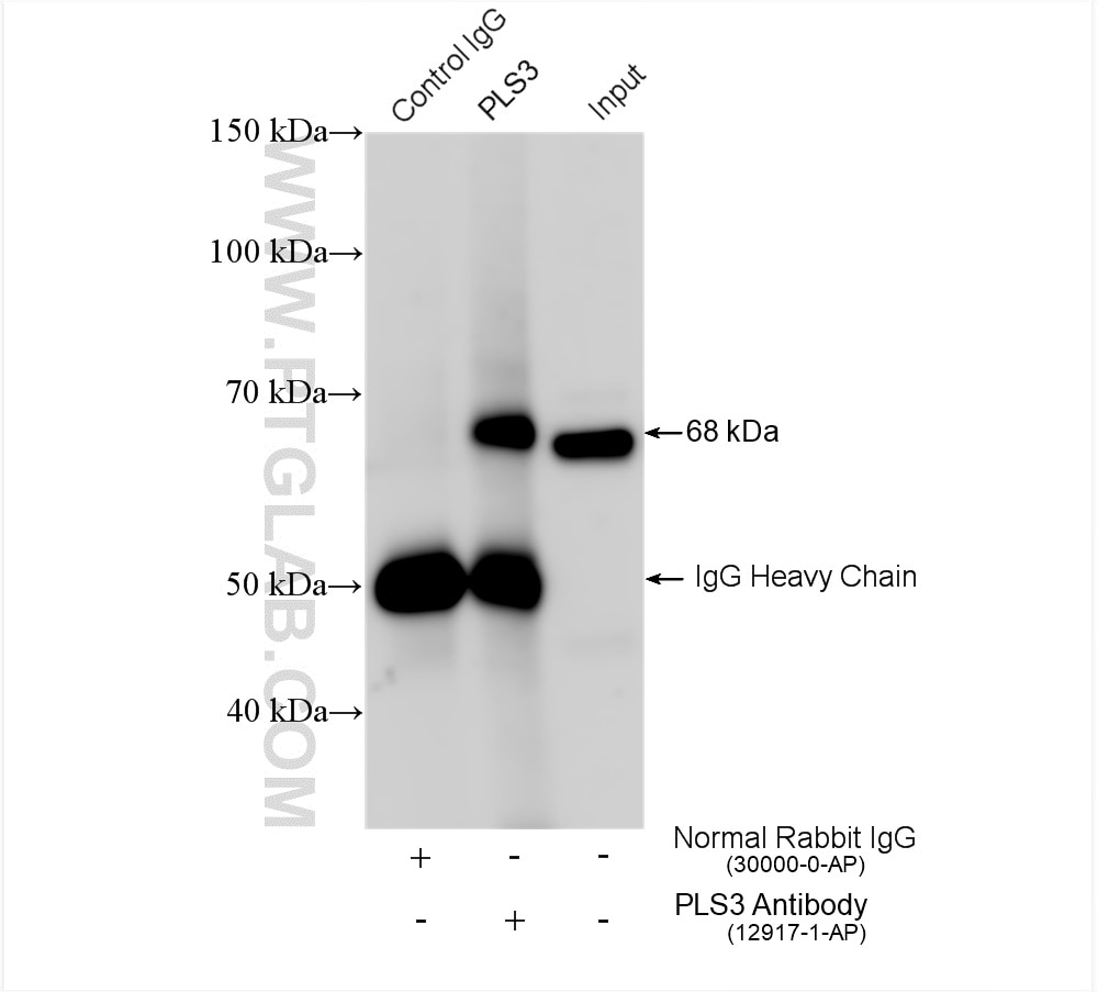 Immunoprecipitation (IP) experiment of A431 cells using PLS3 Polyclonal antibody (12917-1-AP)