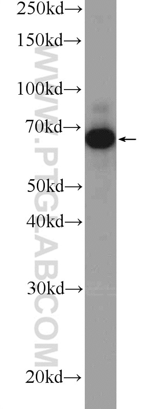 Western Blot (WB) analysis of A431 cells using PLS3 Polyclonal antibody (12917-1-AP)