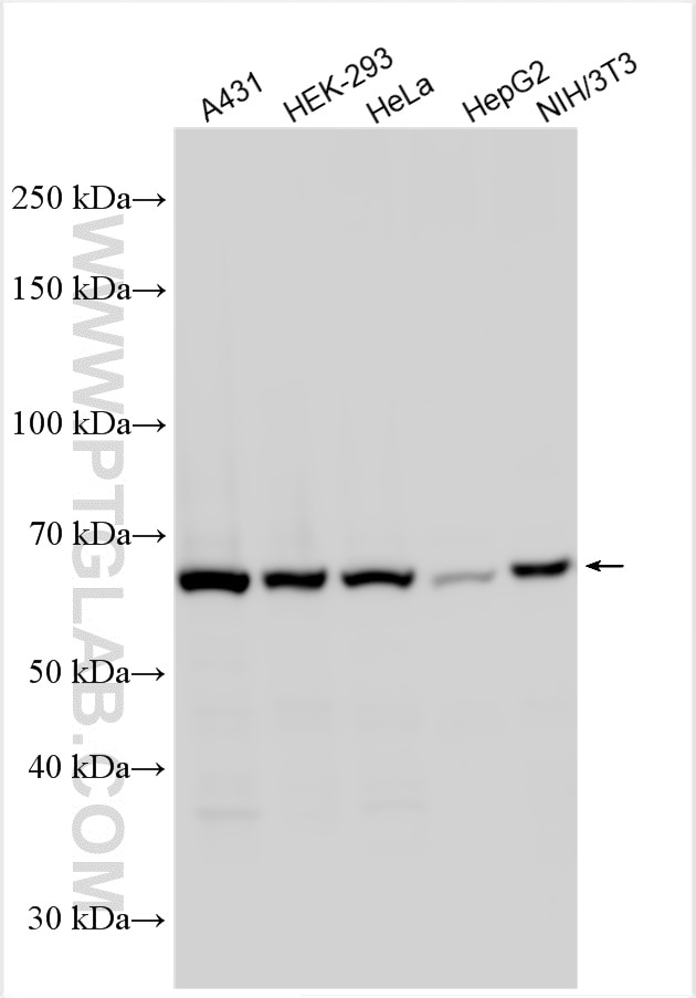 Western Blot (WB) analysis of various lysates using PLS3 Polyclonal antibody (12917-1-AP)
