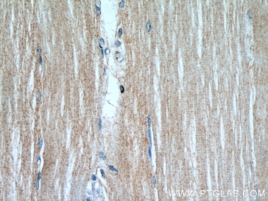 Immunohistochemistry (IHC) staining of human skeletal muscle tissue using PLS3 Polyclonal antibody (55216-1-AP)