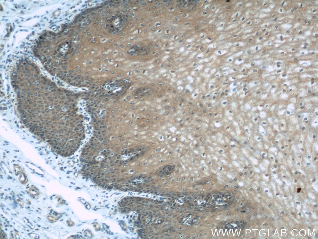 Immunohistochemistry (IHC) staining of human oesophagus tissue using PLS3 Polyclonal antibody (55216-1-AP)