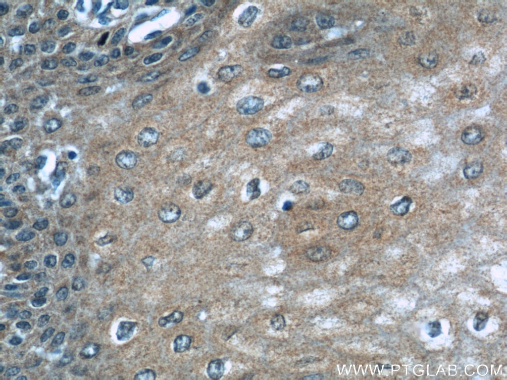 Immunohistochemistry (IHC) staining of human oesophagus tissue using PLS3 Polyclonal antibody (55216-1-AP)
