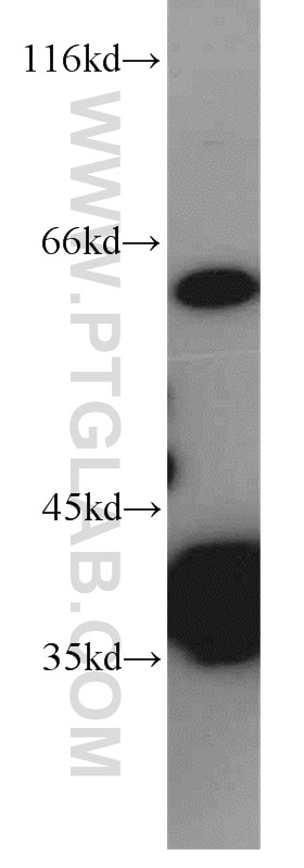 Western Blot (WB) analysis of HeLa cells using PLS3 Polyclonal antibody (55216-1-AP)