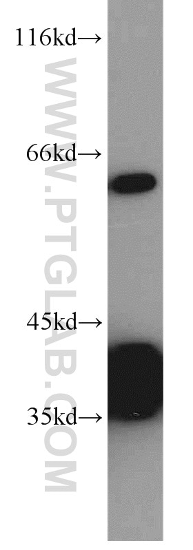 Western Blot (WB) analysis of HeLa cells using PLS3 Polyclonal antibody (55216-1-AP)