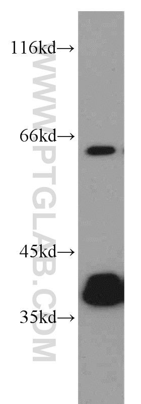 Western Blot (WB) analysis of HepG2 cells using PLS3 Polyclonal antibody (55216-1-AP)