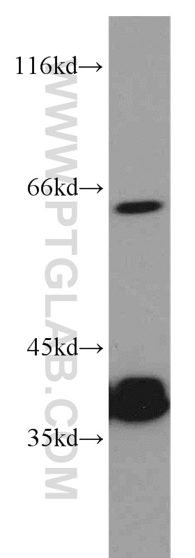 Western Blot (WB) analysis of HepG2 cells using PLS3 Polyclonal antibody (55216-1-AP)