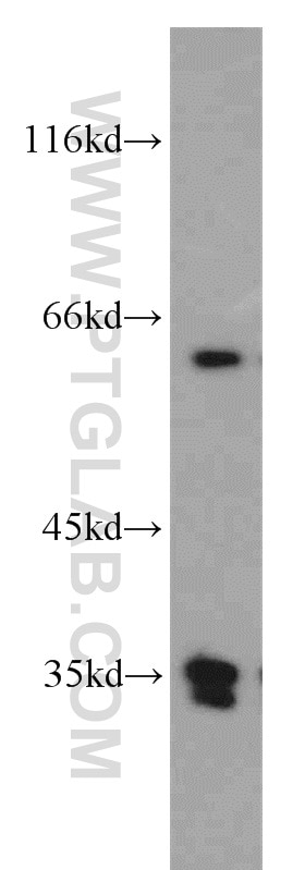 Western Blot (WB) analysis of COLO 320 cells using PLS3 Polyclonal antibody (55216-1-AP)