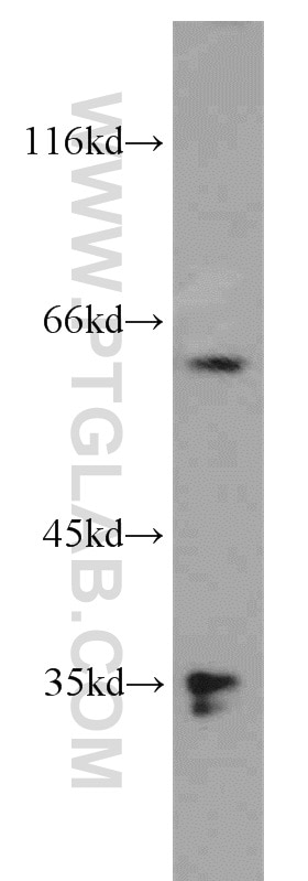 Western Blot (WB) analysis of COLO 320 cells using PLS3 Polyclonal antibody (55216-1-AP)