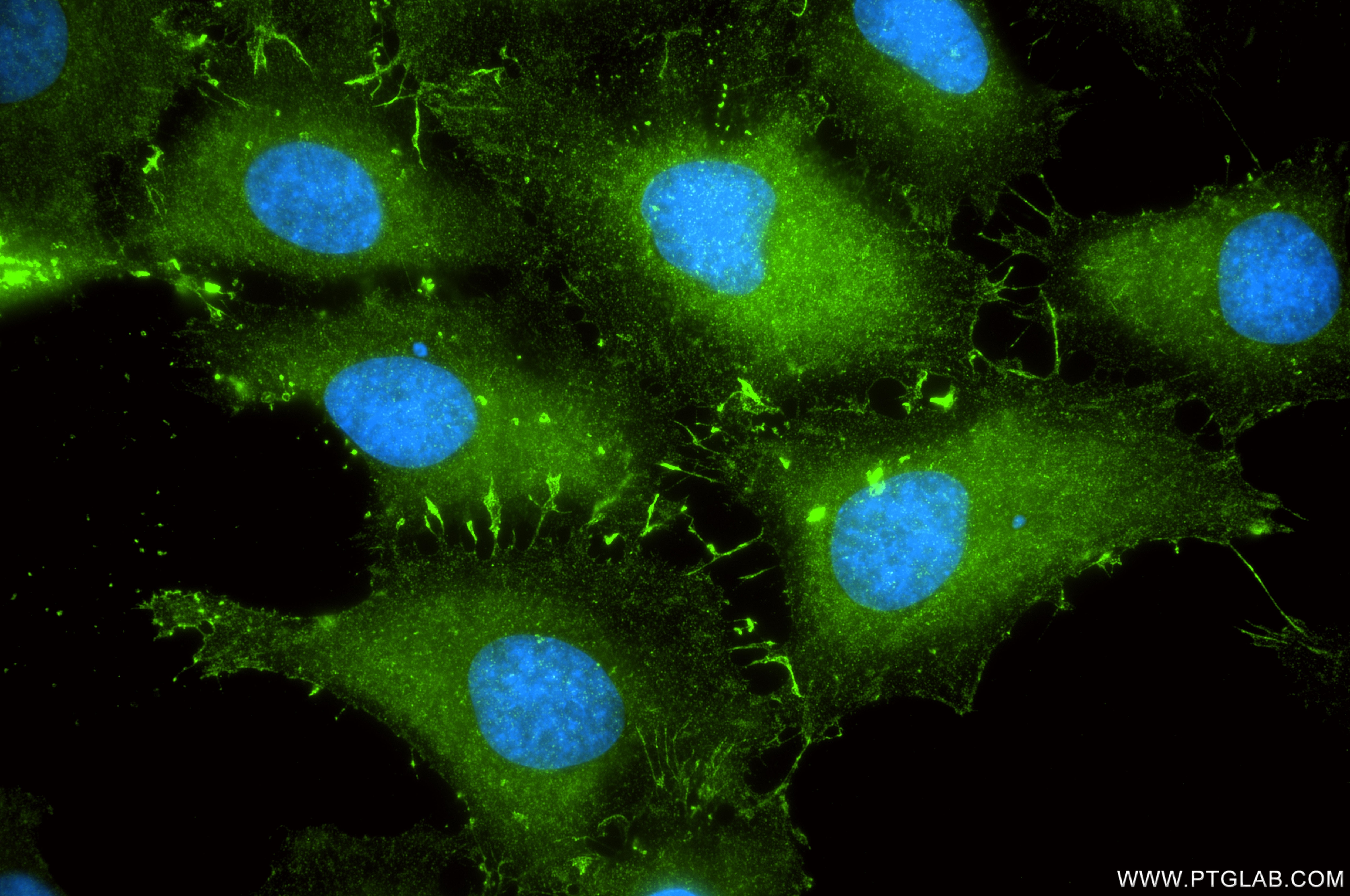 Immunofluorescence (IF) / fluorescent staining of HeLa cells using PLS3 Recombinant monoclonal antibody (86323-1-RR)