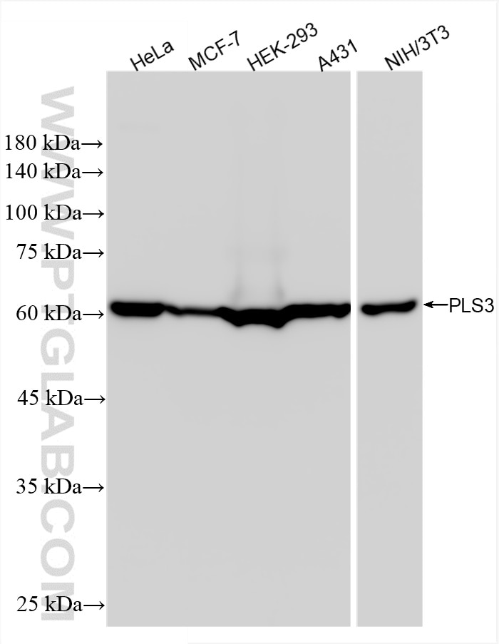 Western Blot (WB) analysis of various lysates using PLS3 Recombinant antibody (86323-1-RR)
