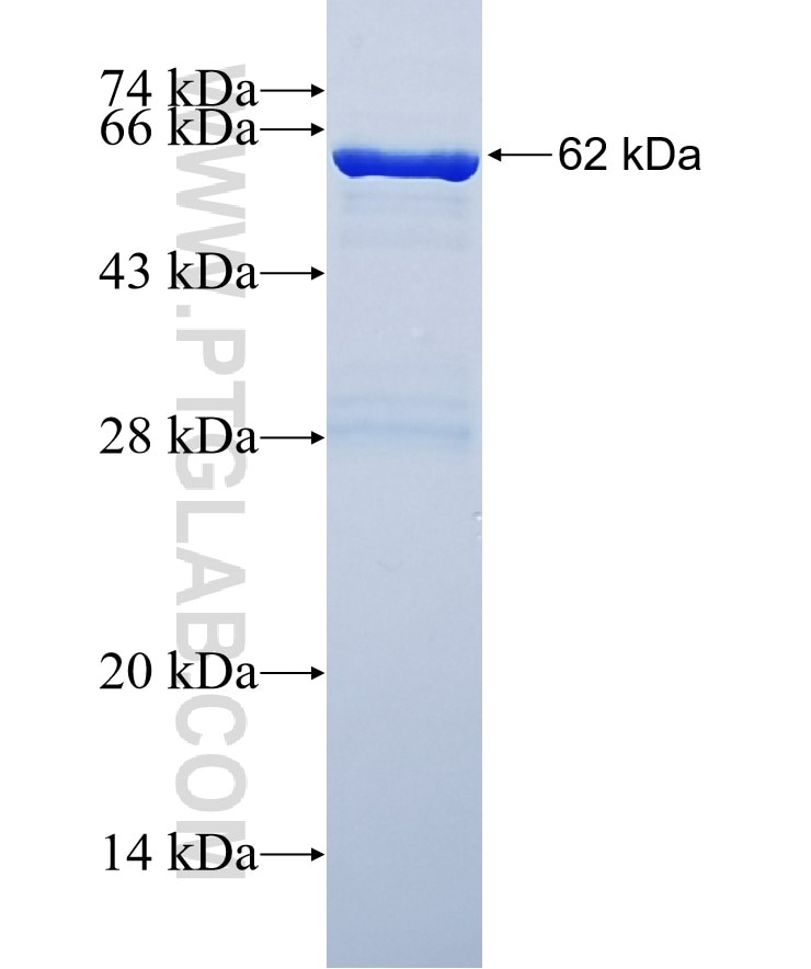 PLS3 fusion protein Ag3574 SDS-PAGE