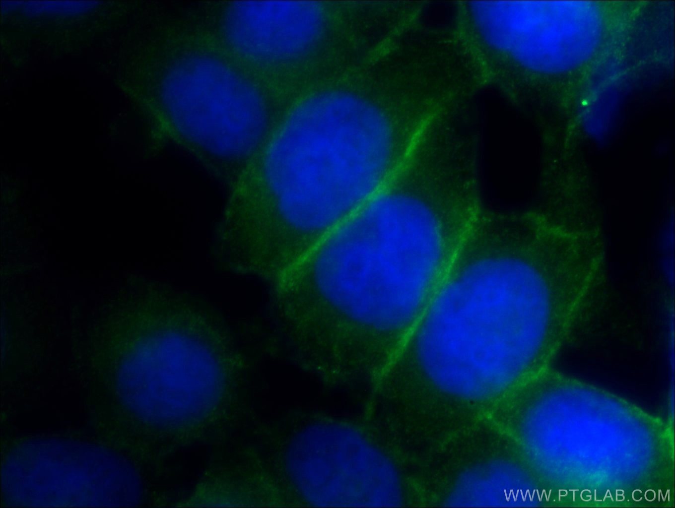 Immunofluorescence (IF) / fluorescent staining of HeLa cells using PLSCR1 Polyclonal antibody (11582-1-AP)