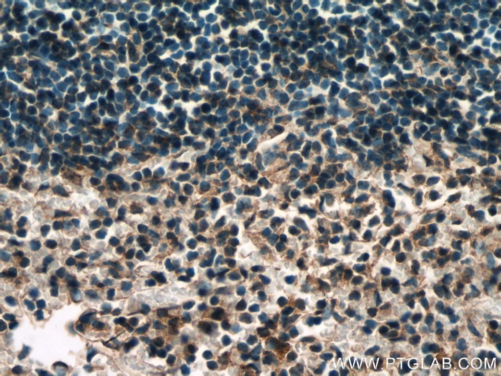 Immunohistochemistry (IHC) staining of mouse spleen tissue using PLSCR1 Polyclonal antibody (11582-1-AP)