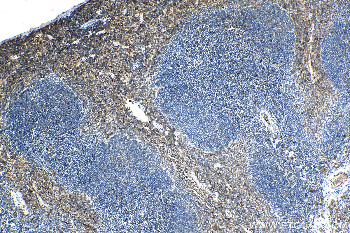 Immunohistochemistry (IHC) staining of mouse spleen tissue using PLSCR1 Polyclonal antibody (11582-1-AP)
