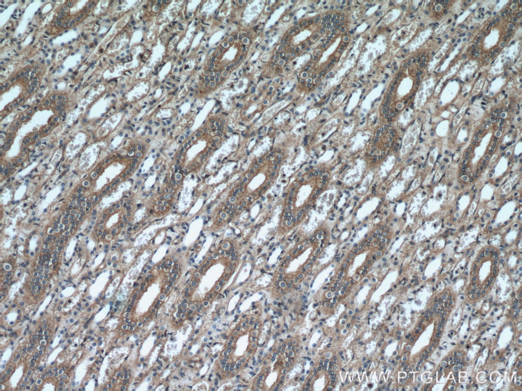 IHC staining of human kidney using 11582-1-AP