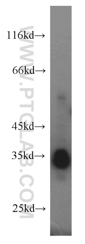 Western Blot (WB) analysis of HEK-293 cells using PLSCR1 Polyclonal antibody (11582-1-AP)
