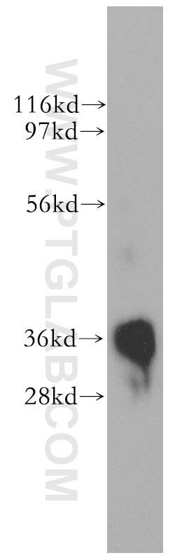 Western Blot (WB) analysis of human skeletal muscle tissue using PLSCR1 Polyclonal antibody (11582-1-AP)
