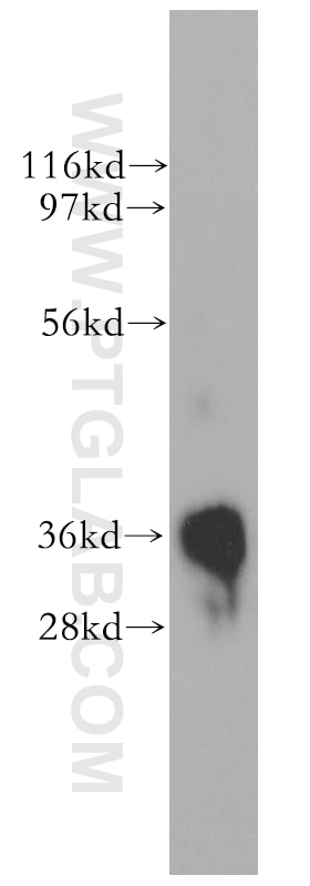 WB analysis of human skeletal muscle using 11582-1-AP