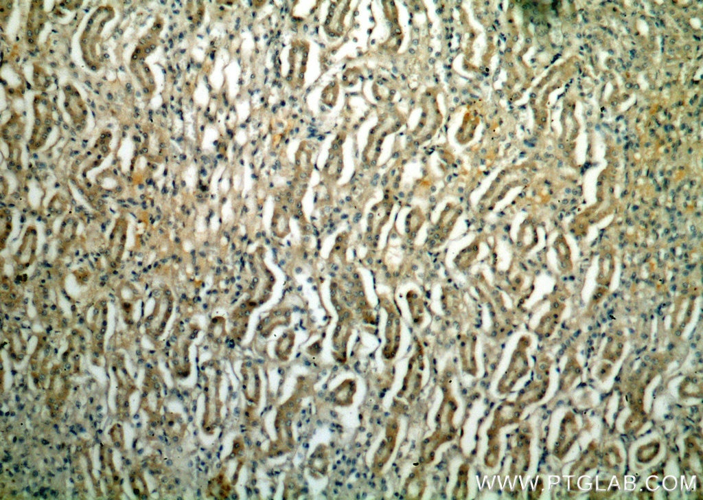 Immunohistochemistry (IHC) staining of human kidney tissue using PLSCR3 Polyclonal antibody (51061-2-Ig)