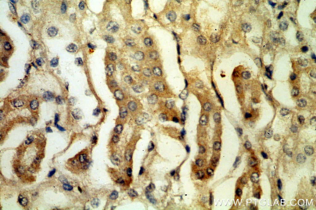 Immunohistochemistry (IHC) staining of human kidney tissue using PLSCR3 Polyclonal antibody (51061-2-Ig)