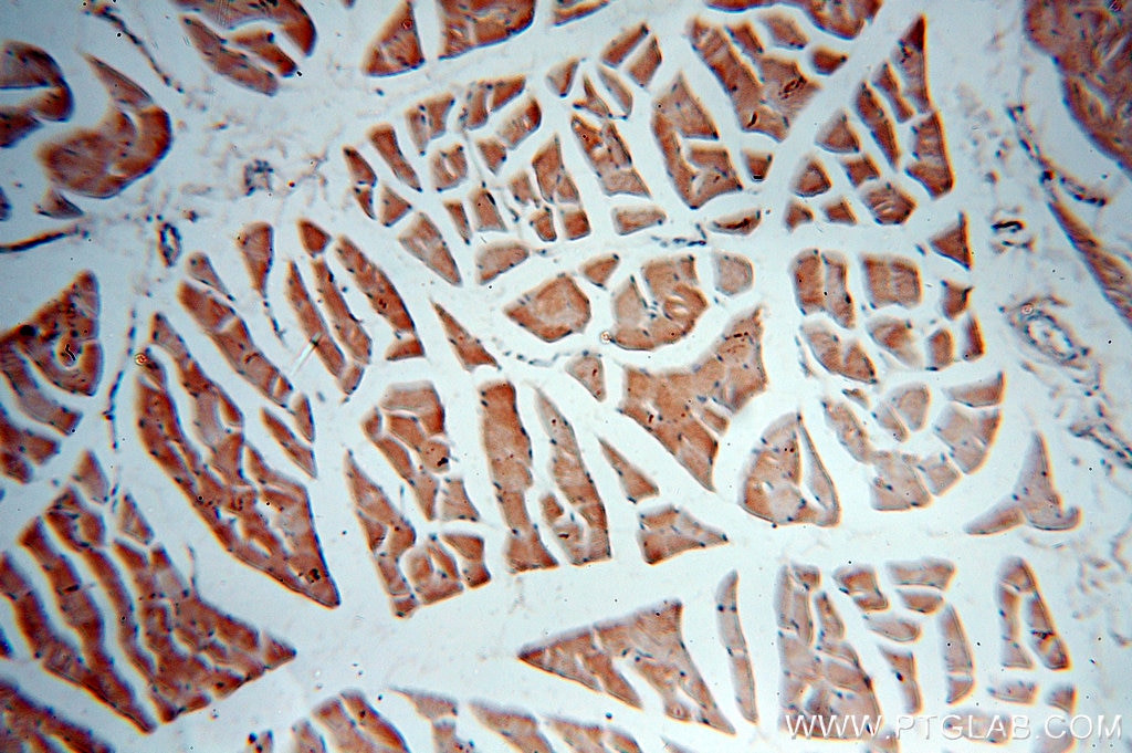 Immunohistochemistry (IHC) staining of human skeletal muscle tissue using PLSCR3 Polyclonal antibody (51061-2-Ig)