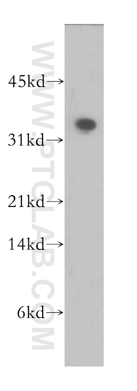 Western Blot (WB) analysis of human heart tissue using PLSCR4 Polyclonal antibody (12630-1-AP)