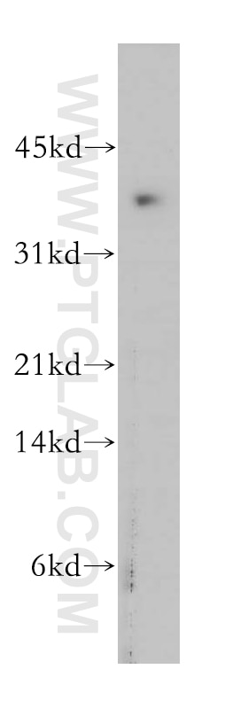 Western Blot (WB) analysis of human brain tissue using PLSCR4 Polyclonal antibody (12630-1-AP)