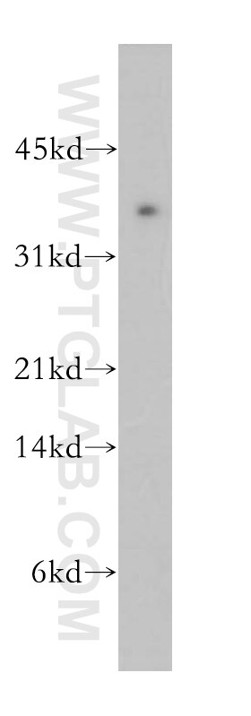 Western Blot (WB) analysis of human placenta tissue using PLSCR4 Polyclonal antibody (12630-1-AP)