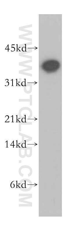 Western Blot (WB) analysis of human liver tissue using PLSCR4 Polyclonal antibody (12630-1-AP)