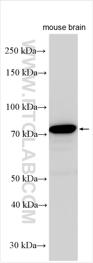 WB analysis using 15635-1-AP