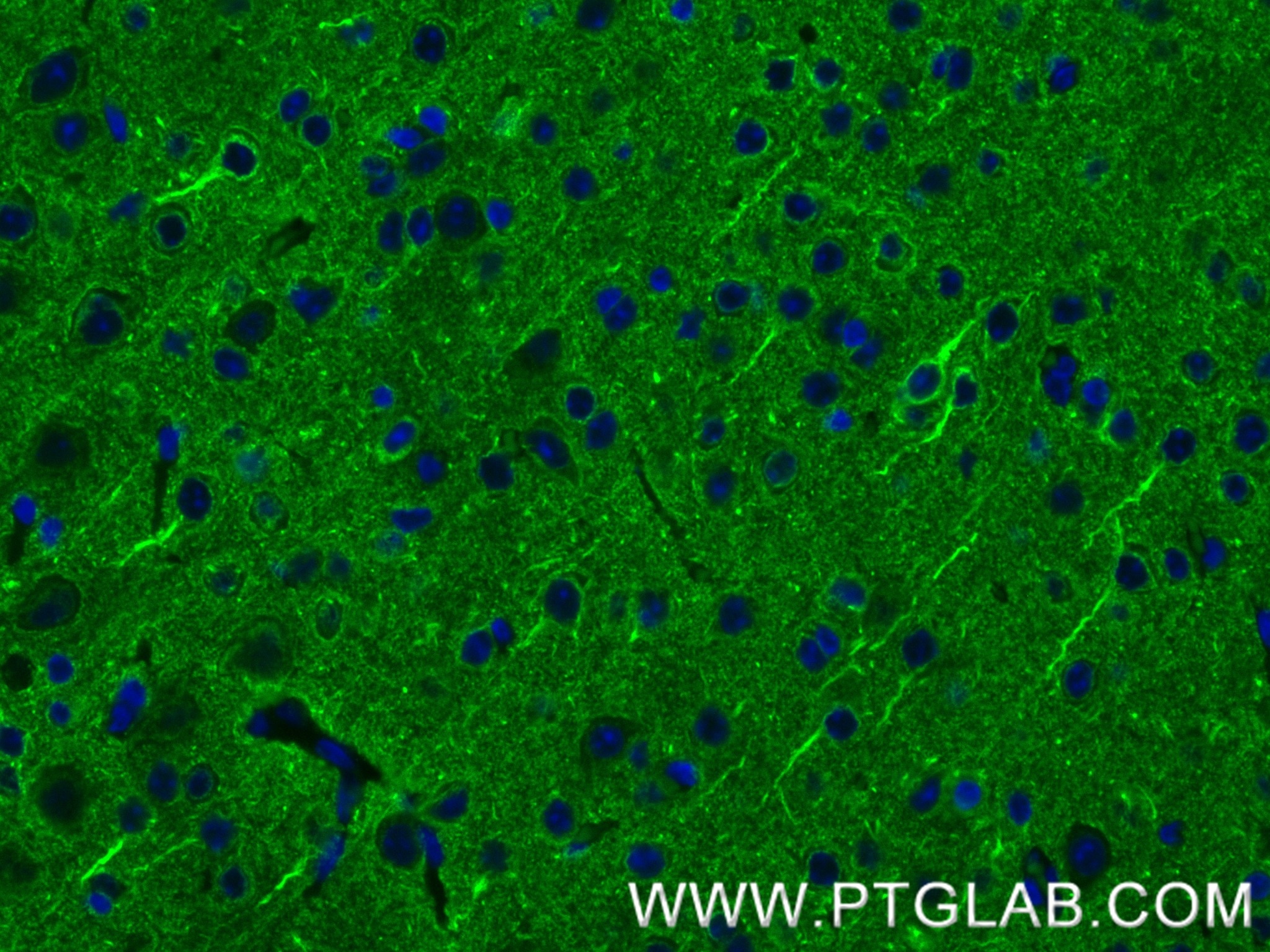 Immunofluorescence (IF) / fluorescent staining of mouse brain tissue using PLTP Recombinant antibody (84592-1-RR)
