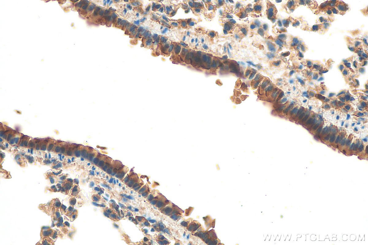 Immunohistochemistry (IHC) staining of mouse lung tissue using PLUNC Polyclonal antibody (10413-1-AP)