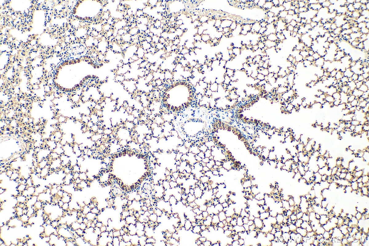 Immunohistochemistry (IHC) staining of mouse lung tissue using PLUNC Polyclonal antibody (10413-1-AP)