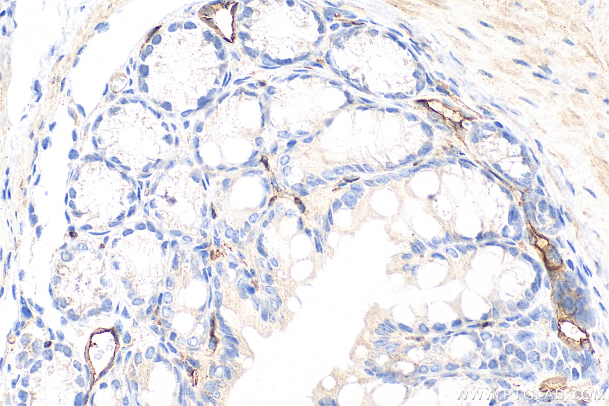 Immunohistochemistry (IHC) staining of mouse colon tissue using PLVAP Polyclonal antibody (14452-1-AP)