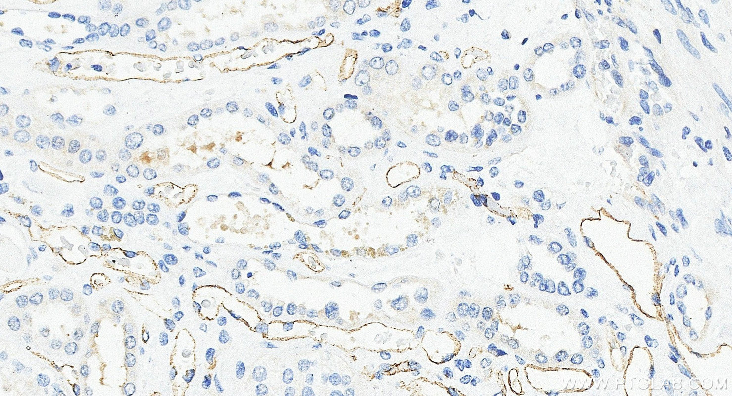 Immunohistochemistry (IHC) staining of human kidney tissue using PLVAP Polyclonal antibody (14452-1-AP)