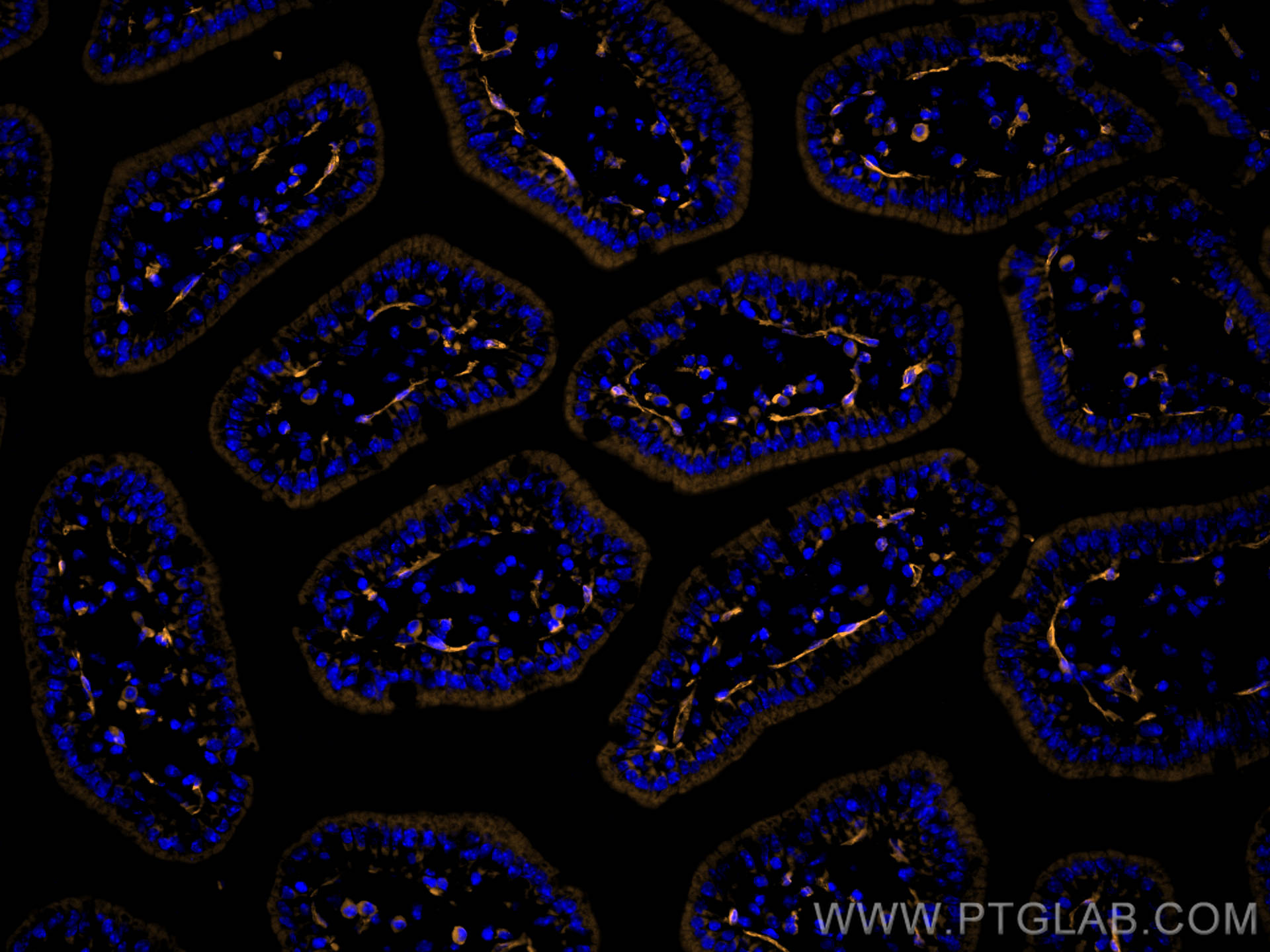 Immunofluorescence (IF) / fluorescent staining of mouse small intestine tissue using Anti-Mouse PLVAP (MECA-32) (65214-1-Ig)