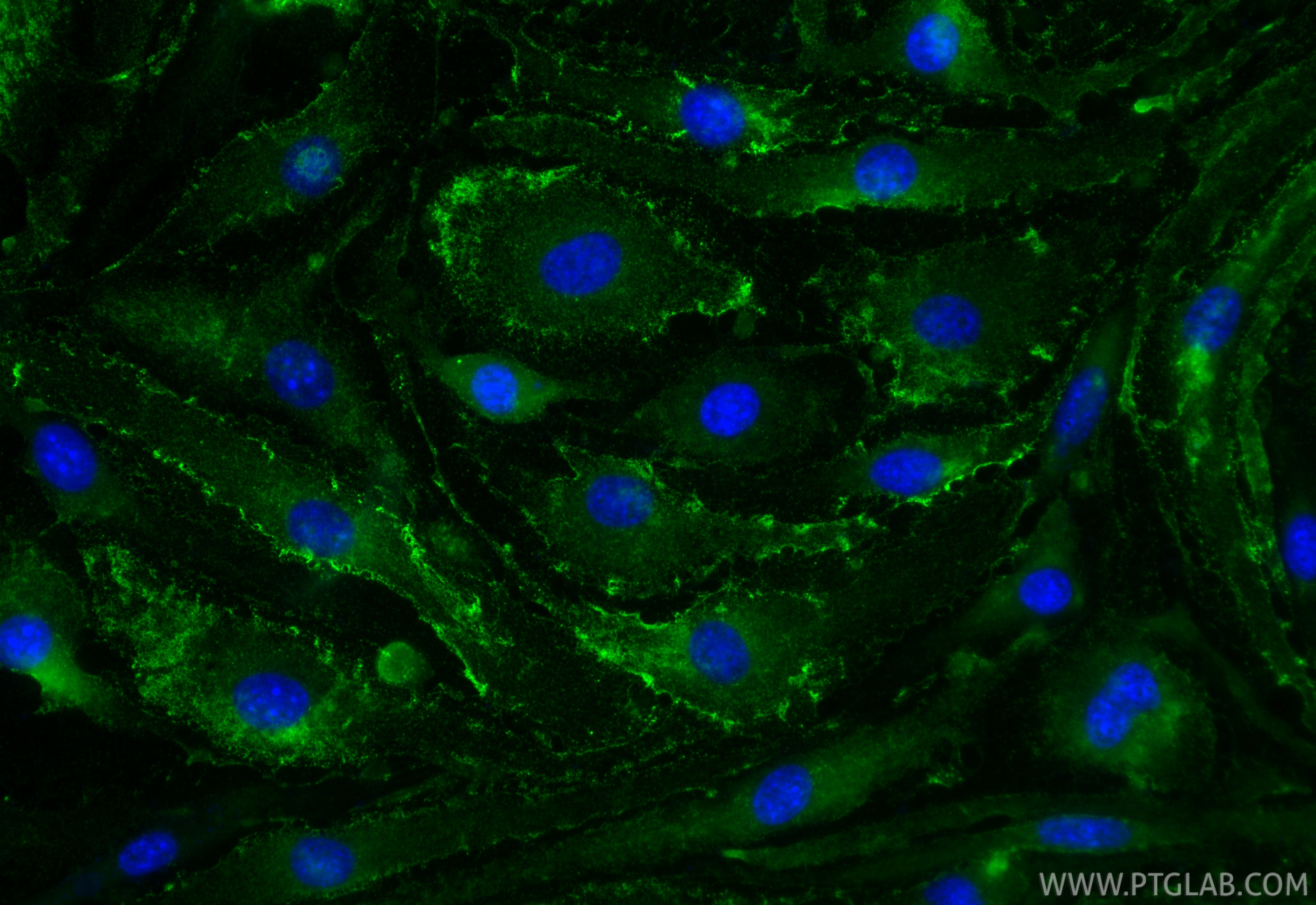 IF Staining of bEnd.3 using 65214-1-Ig Immunofluorescence (IF) / fluorescent staining of bEnd.3 cells using Anti-Mouse PLVAP (MECA-32) (65214-1-Ig)