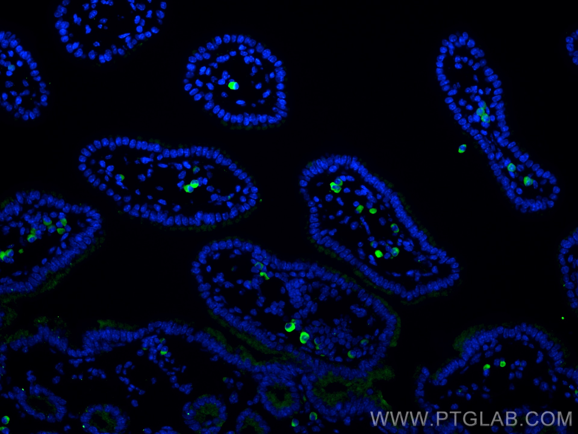 Immunofluorescence (IF) / fluorescent staining of mouse small intestine tissue using PLVAP Monoclonal antibody (67158-1-Ig)