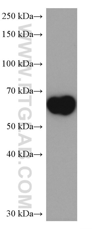 WB analysis of human placenta using 67158-1-Ig