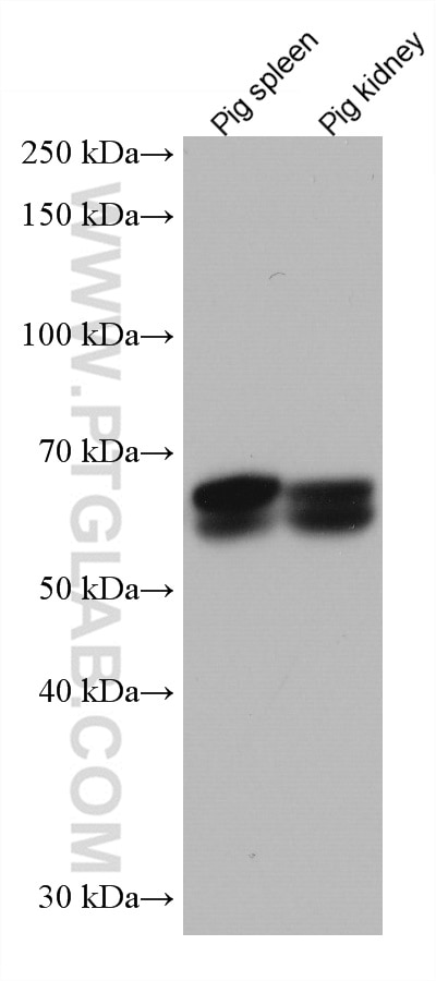 Western Blot (WB) analysis of various lysates using PLVAP Monoclonal antibody (67158-1-Ig)