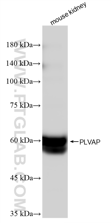 Western Blot (WB) analysis of various lysates using PLVAP Recombinant monoclonal antibody (87712-1-RR)