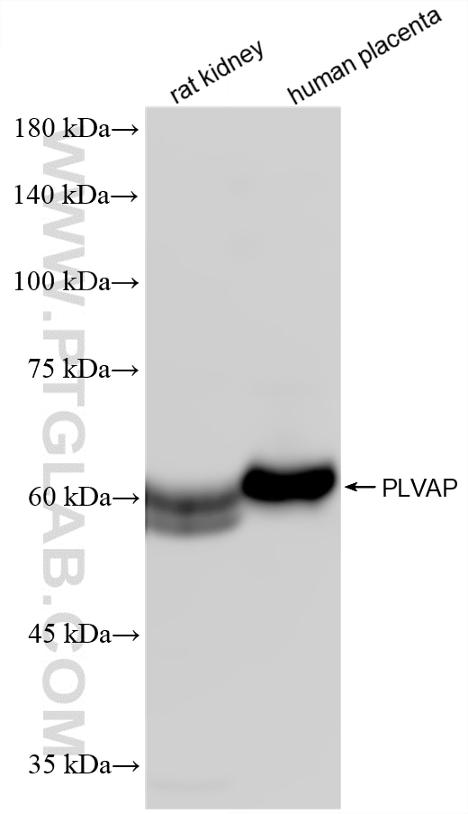 Western Blot (WB) analysis of various lysates using PLVAP Recombinant monoclonal antibody (87712-1-RR)