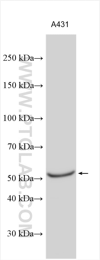 Western Blot (WB) analysis of A431 cells using PLXDC2 Polyclonal antibody (12285-1-AP)