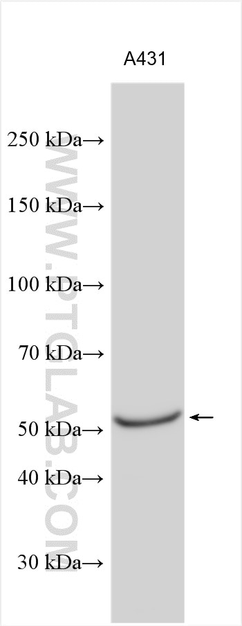 WB analysis of A431 using 12285-1-AP