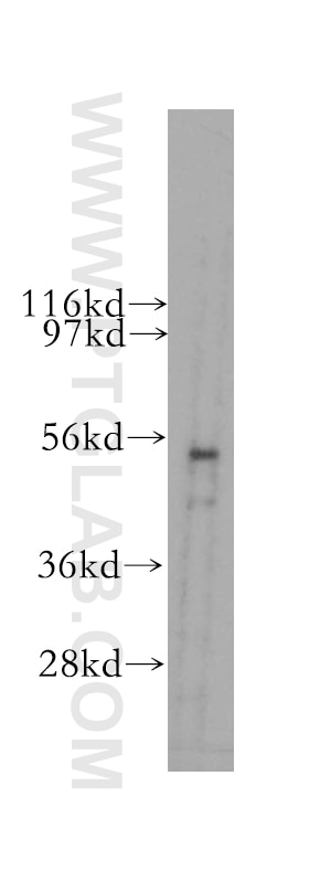 Western Blot (WB) analysis of HeLa cells using PLXDC2 Polyclonal antibody (12285-1-AP)