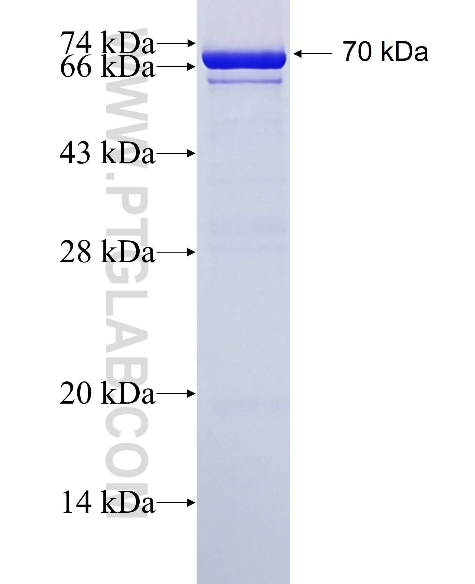 PLXDC2 fusion protein Ag2940 SDS-PAGE