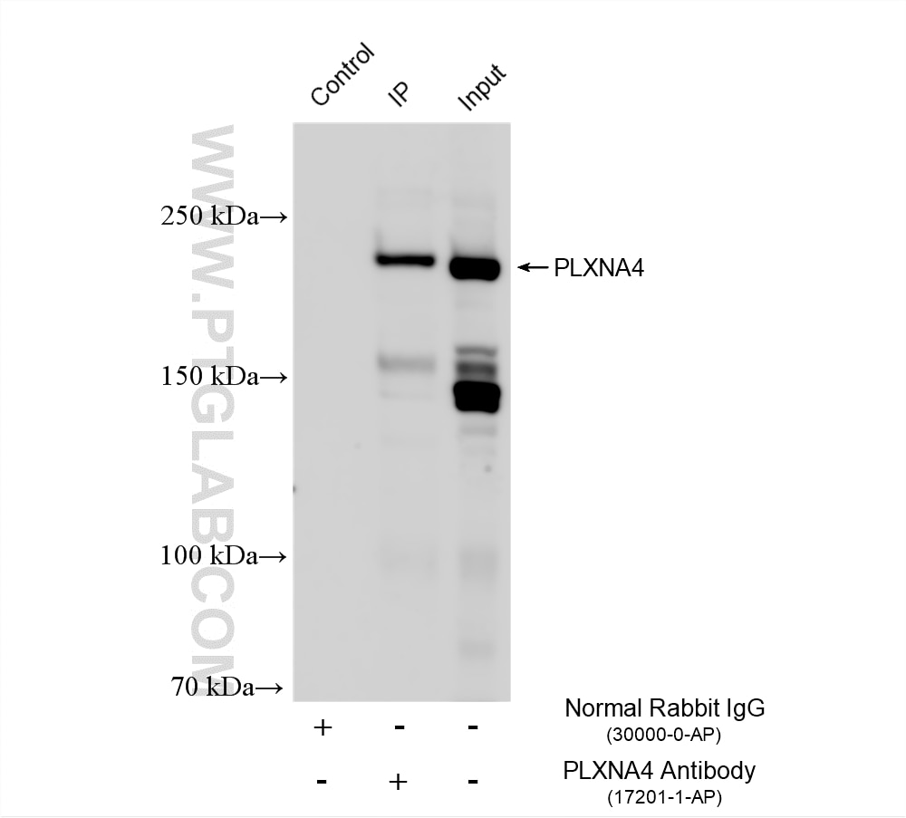 Immunoprecipitation (IP) experiment of mouse brain tissue using PLXNA4 Polyclonal antibody (17201-1-AP)